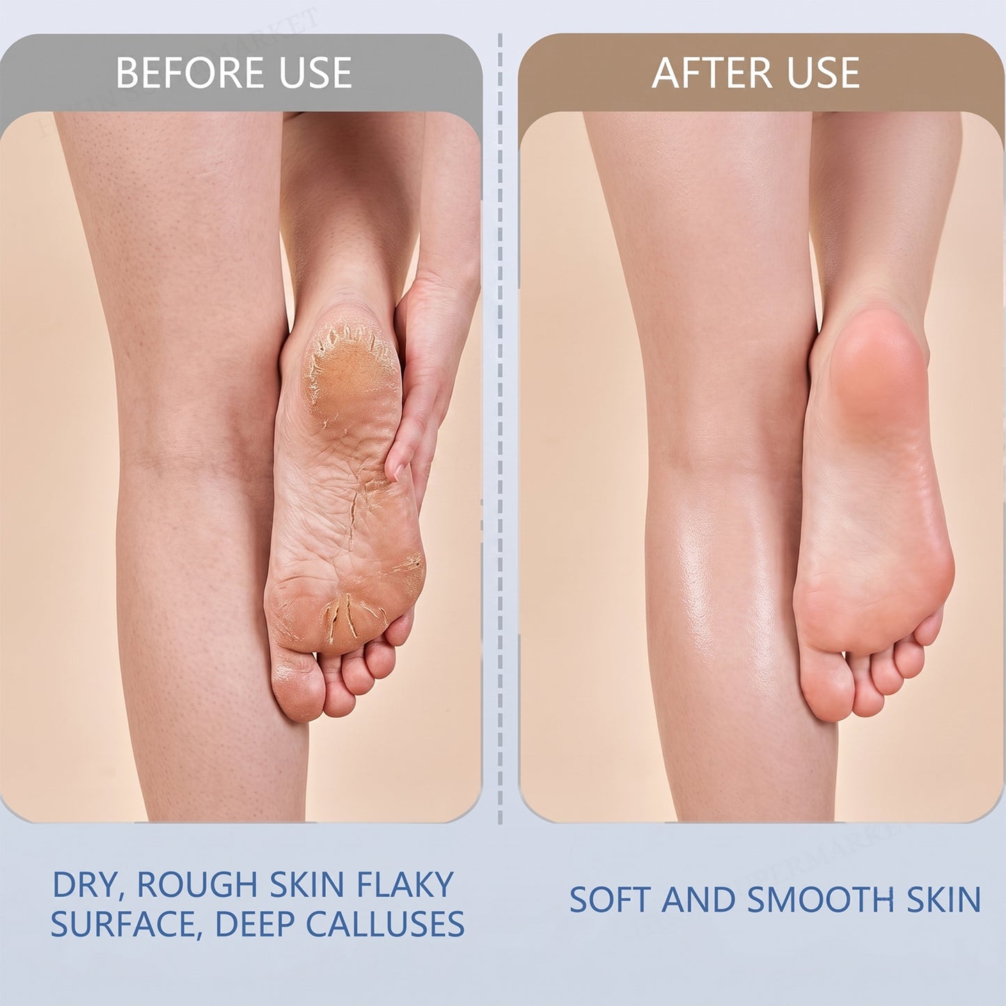 Portable Electric Foot File – Rechargeable Callus Remover & Pedicure Tool for Smooth Feet